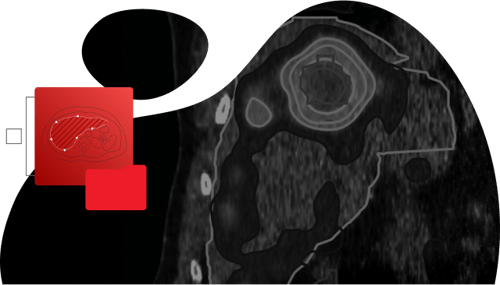 Webinar-DosimetryWebinar