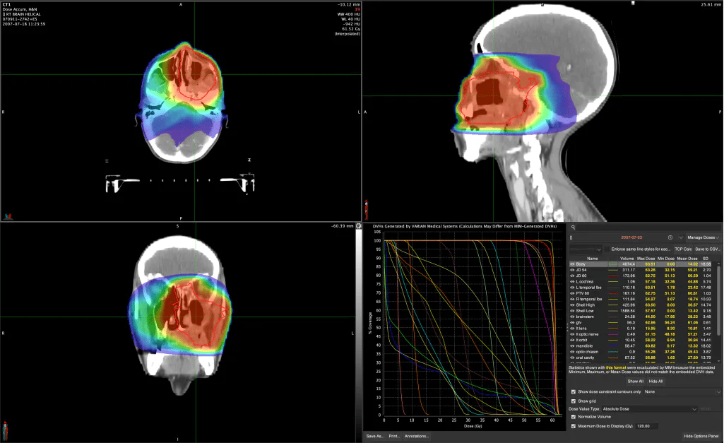 dose accum screen@.5x