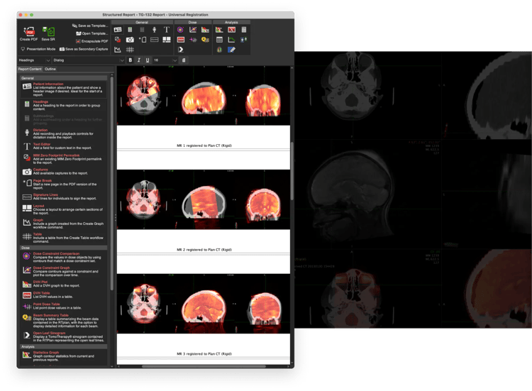 universal image registration screen-1 universal image registration screen-1