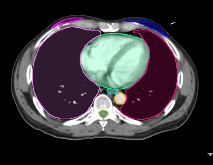 Medical image of internal body part Medical image of internal body part