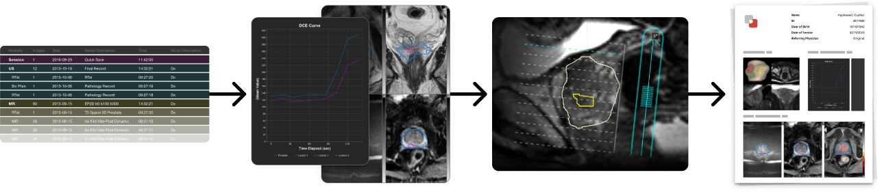 Flow graphic starting with a data table, into a line graph and medical scan, into a medical scan with contours, into a image of a report. Flow graphic starting with a data table, into a line graph and medical scan, into a medical scan with contours, into a image of a report.