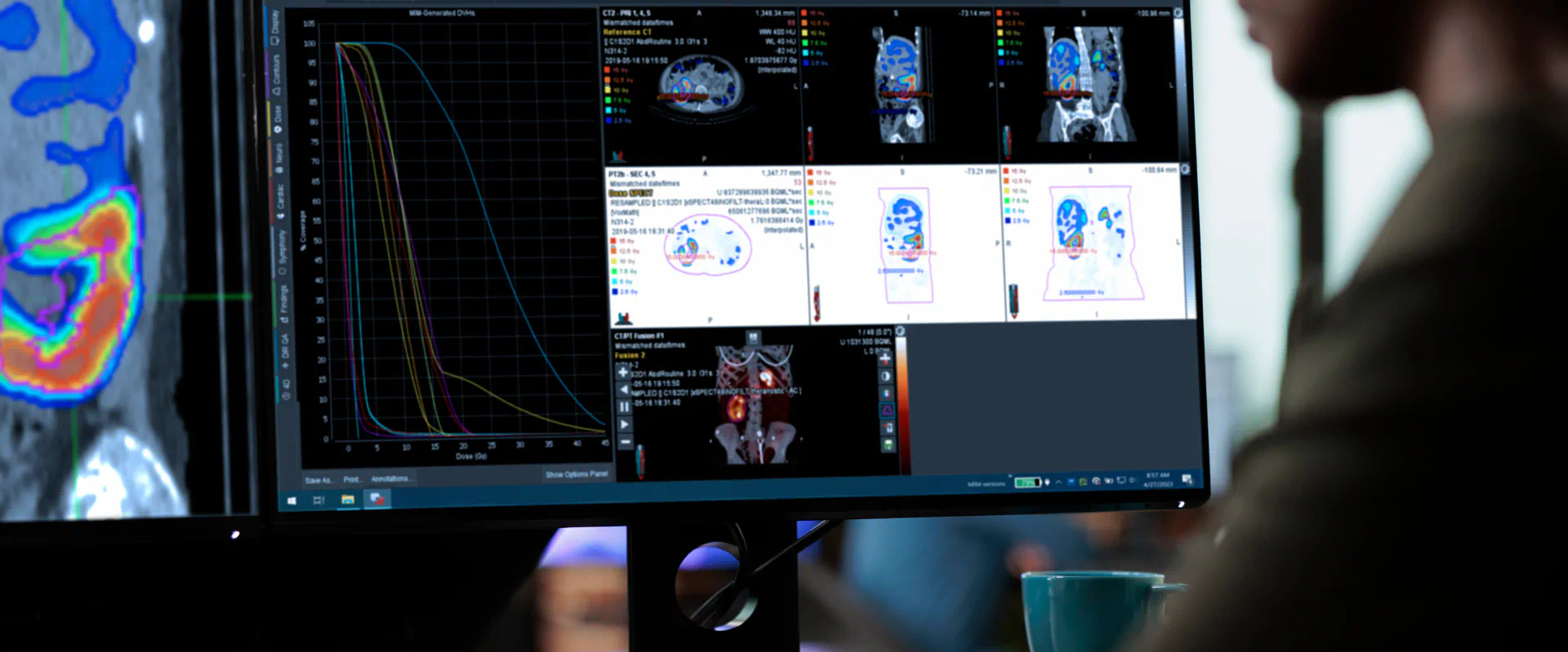 Female doctor sitting behind a computer screen that has medical scans displaying.